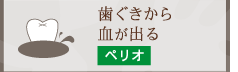 歯ぐきから血が出る ペリオ